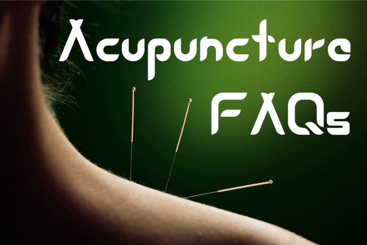 Image of acupuncture needles with text Acupuncture FAQs