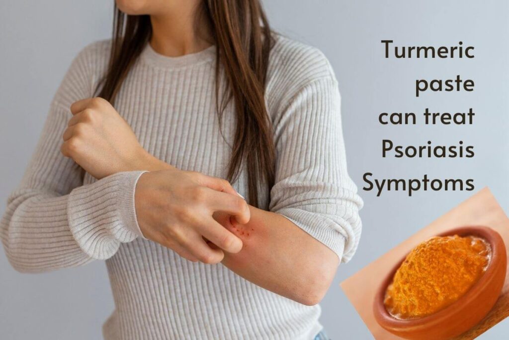 Image of turmeric paste used to treat Psoriasis symptoms