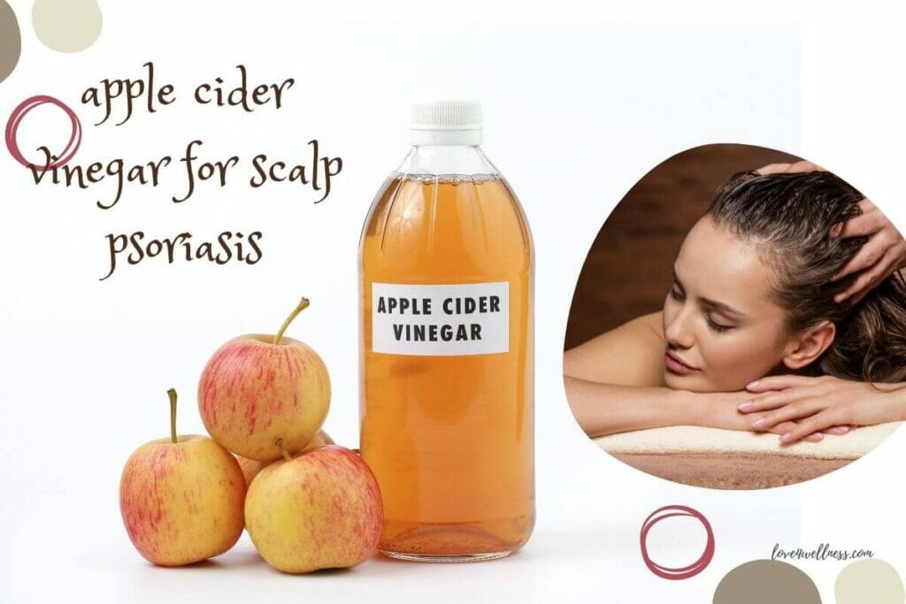 Psoriasis on scalp home remedy - Apple cider vinegar