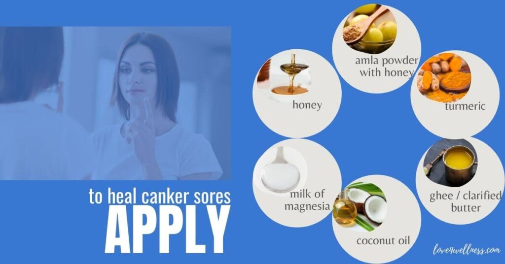 Infographic: Topical application home remedies for mouth ulcers