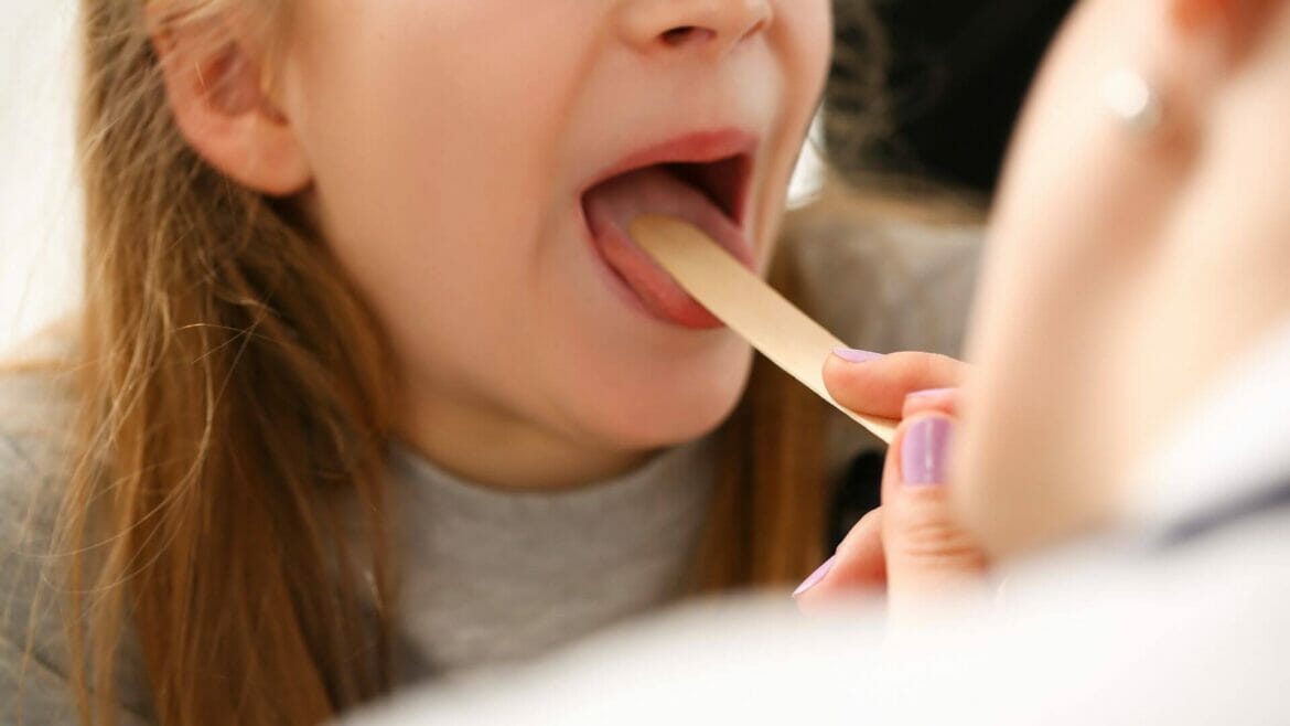 girl-getting-throat-examination (1) Image of a small girl getting checked for enlarged adenoids
