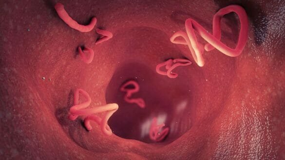 Illustration of intestinal parasites/worms infestation in the human body