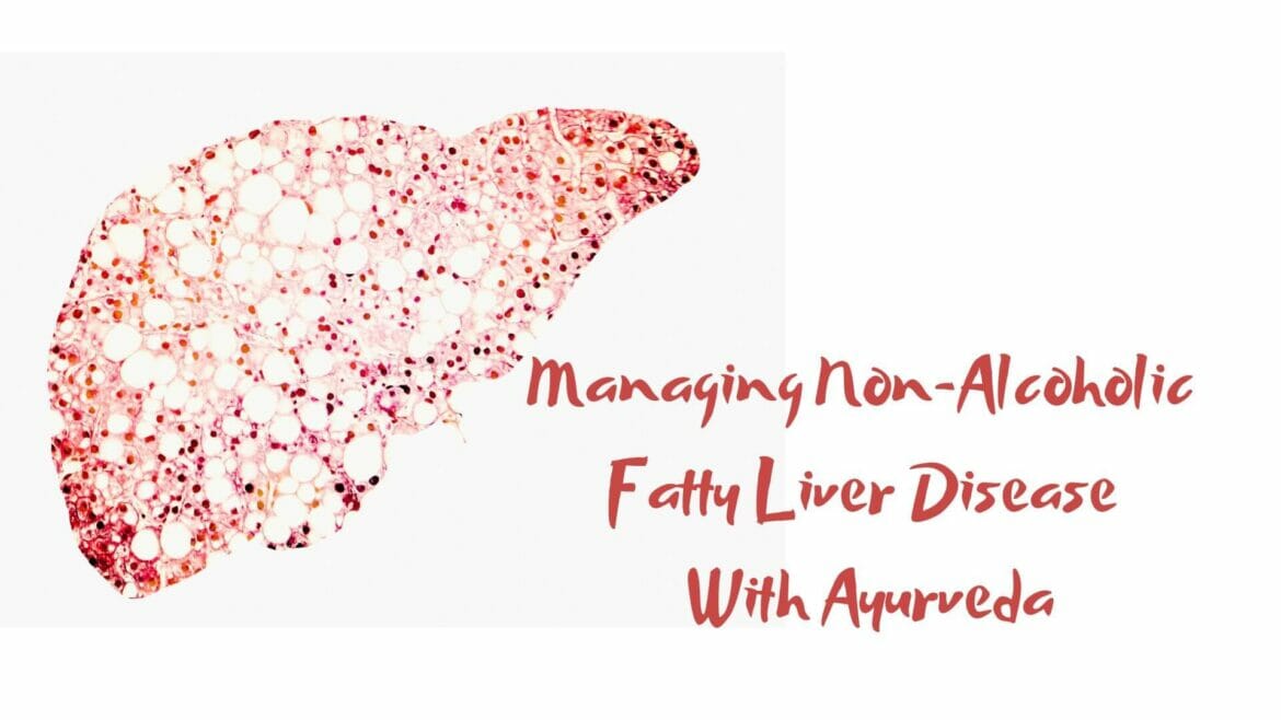 Image of liver with text Managing Non-alcoholic fatty liver disease (NAFLD) with Ayurveda