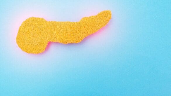 Representation of Pancreatitis